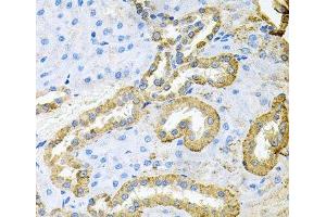 Immunohistochemistry of paraffin-embedded Rat kidney using ABL1 Polyclonal Antibody at dilution of 1:100 (40x lens). (ABL1 antibody)