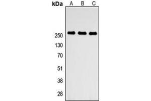 Western blot analysis of ABCA4 expression in HEK293T (A), NS-1 (B), PC12 (C) whole cell lysates. (ABCA4 antibody  (Center))
