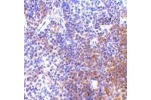 Immunohistochemistry of IRF7 in mouse spleen tissue with IRF7 antibody at 5 μg/ml. (IRF7 antibody  (C-Term))
