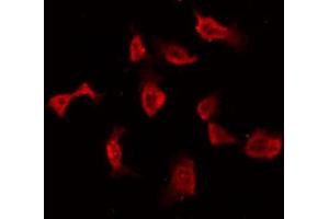 ABIN6269167 staining NIH-3T3 by IF/ICC. (PKC alpha antibody  (C-Term))