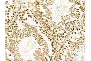 ABIN6261140 and ABIN6268860 at 1/100 staining Rat testis tissue by IHC-P. (Cyclin A1 antibody  (C-Term))