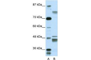 WB Suggested Anti-ZNF607 Antibody Titration:  0.