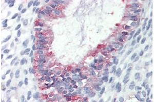 Human Uterus (formalin-fixed, paraffin-embedded) stained with GPR27 antibody ABIN410771 followed by biotinylated goat anti-rabbit IgG secondary antibody ABIN481713, alkaline phosphatase-streptavidin and chromogen. (GPR27 antibody  (Internal Region))