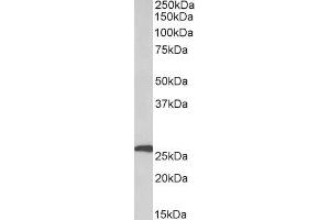 ABIN5539473 (1µg/ml) staining of Human Adipose lysate (35µg protein in RIPA buffer). (Adipsin antibody  (Internal Region))
