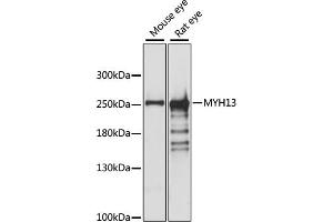 Western blot analysis of extracts of various cell lines, using MYH13 antibody (ABIN7268746) at 1:1000 dilution. (MYH13 antibody  (AA 1240-1320))