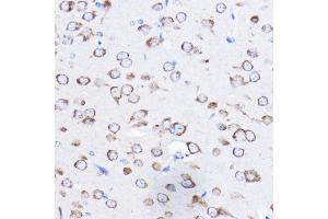 Immunohistochemistry of paraffin-embedded mouse brain using RPL8 Rabbit pAb (ABIN6128659, ABIN6147155, ABIN6147156 and ABIN6214154) at dilution of 1:50 (40x lens). (RPL8 antibody  (AA 1-257))