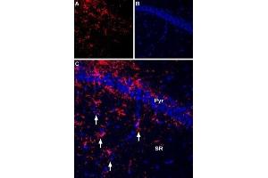 Expression of P2RX7 in rat hippocampus - Immunohistochemical staining of rat hippocampus frozen section using Anti-P2X7 Receptor-ATTO Fluor-550 Antibody (ABIN7043577), (1:60).
