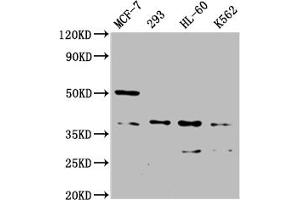 Western Blot Positive WB detected in: MCF-7 whole cell lysate, 293 whole cell lysate, HL60 whole cell lysate, K562 whole cell lysate All lanes: MRGPRX2 antibody at 1:2000 Secondary Goat polyclonal to rabbit IgG at 1/50000 dilution Predicted band size: 38 kDa Observed band size: 38 kDa (MRGPRX2 antibody  (AA 286-330))