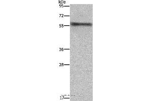 Western blot analysis of Mouse heart tissue, using FKBP8 Polyclonal Antibody at dilution of 1:1000 (FKBP8 antibody)