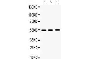 Western Blotting (WB) image for anti-Matrix Metallopeptidase 10 (Stromelysin 2) (MMP10) (AA 409-443), (C-Term) antibody (ABIN3043406) (MMP10 antibody  (C-Term))