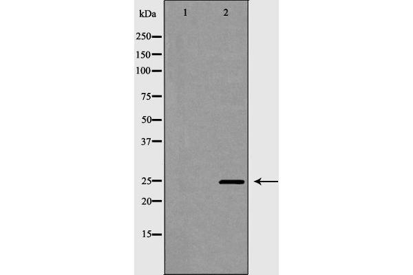 PDCD10 antibody  (Internal Region)