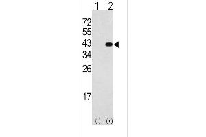 Western blot analysis of DK2(arrow) using rabbit polyclonal DK2 Antibody (N-term) 7218a. (DAPK2 antibody  (N-Term))