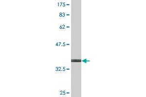 Western Blot detection against Immunogen (36. (Transgelin antibody  (AA 19-112))