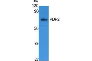 Western Blotting (WB) image for anti-Pyruvate Dehyrogenase Phosphatase Catalytic Subunit 2 (PDP2) (Internal Region) antibody (ABIN3187635)