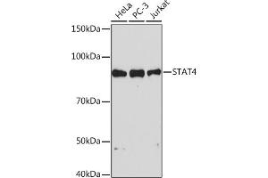 Western blot analysis of extracts of various cell lines, using ST Rabbit mAb (ABIN1681118, ABIN7101700, ABIN7101701 and ABIN7101702) at 1:1000 dilution.
