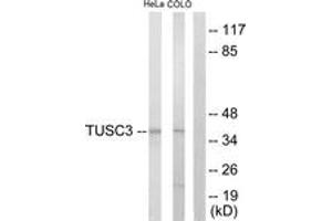 Western blot analysis of extracts from COLO205/HeLa cells, using TUSC3 Antibody. (TUSC3 antibody  (AA 131-180))