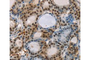 Immunohistochemistry (IHC) image for anti-Runt-Related Transcription Factor 1, Translocated To, 1 (Cyclin D-Related) (RUNX1T1) antibody (ABIN2427103)
