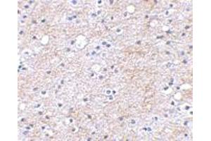 Immunohistochemical staining of human brain tissue using LGI1 polyclonal antibody  at 2. (LGI1 antibody  (Internal Region))