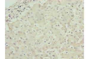 Immunohistochemistry of paraffin-embedded human liver tissue using ABIN7142833 at dilution of 1:100 (RPL7L1 antibody  (AA 1-246))