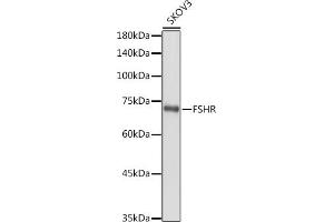 Western blot analysis of extracts of SKOV3 cells, using FSHR antibody (ABIN3022001, ABIN3022002, ABIN3022003, ABIN1512927 and ABIN6218564) at 1:1000 dilution.