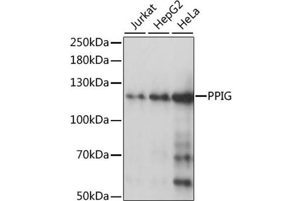 PPIG antibody  (AA 1-100)