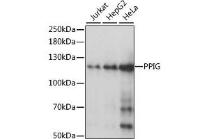 Western blot analysis of extracts of various cell lines, using PPIG antibody (ABIN1513403, ABIN3020977, ABIN3020978 and ABIN6213843) at 1:1000 dilution. (PPIG antibody  (AA 1-100))