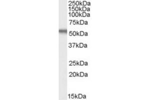 Image no. 1 for anti-Early Growth Response 2 (EGR2) (Internal Region) antibody (ABIN375194) (EGR2 antibody  (Internal Region))