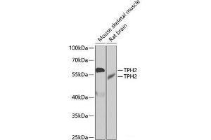 Western blot analysis of extracts of various cell lines using TPH2 Polyclonal Antibody at dilution of 1:1000.