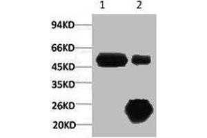 1) Input: Hela Cell Lysate 2) IP product: IP dilute 1:200 (KRT17 antibody)
