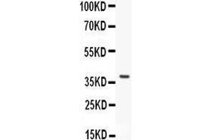 Anti- HOXA11 antibody, Western blotting All lanes: Anti HOXA11  at 0.