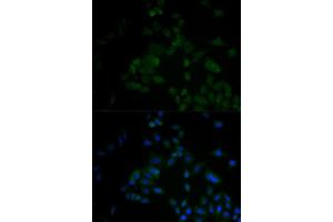 Immunofluorescence analysis of A549 cell using ARF6 antibody. (ARF6 antibody)