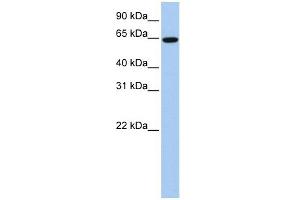EPS8L1 antibody used at 1 ug/ml to detect target protein. (EPS8-Like 1 antibody  (Middle Region))