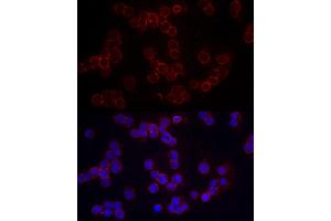 Immunofluorescence analysis of Raji cells using CD86 Rabbit pAb (ABIN3021700, ABIN3021701, ABIN3021702, ABIN1512724 and ABIN6215549) at dilution of 1:200 (40x lens). (CD86 antibody  (AA 30-247))