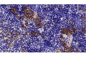 Detection of S100A8 in Mouse Spleen Tissue using Polyclonal Antibody to S100 Calcium Binding Protein A8 (S100A8) (S100A8 antibody  (AA 1-89))