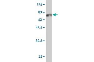 Western Blot detection against Immunogen (66. (HDAC8 antibody  (AA 1-377))