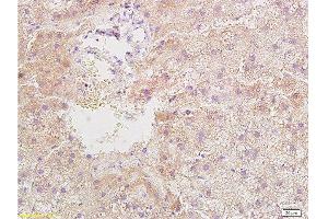 Formalin-fixed and paraffin embedded rat liver tissue with Anti-Resistin Polyclonal Antibody, Unconjugated  at 1:400, followed by conjugation to the secondary antibody and DAB staining (Resistin antibody  (AA 21-114))