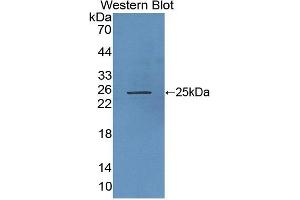 Figure. (RHAG antibody  (AA 251-450))