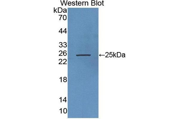 RHAG Antikörper  (AA 251-450)