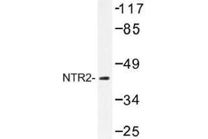 Image no. 1 for anti-Neurotensin Receptor 2 (NTSR2) antibody (ABIN317761) (NTSR2 antibody)