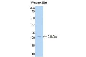 Western Blotting (WB) image for anti-Lanosterol Synthase (2,3-Oxidosqualene-Lanosterol Cyclase) (LSS) (AA 101-250) antibody (ABIN1860103) (LSS antibody  (AA 101-250))