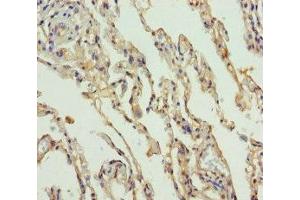 Immunohistochemistry of paraffin-embedded human lung tissue using ABIN7169988 at dilution of 1:100 (Solute Carrier Family 34 (Type II Sodium/phosphate Contransporter), Member 1 (SLC34A1) (AA 1-103) antibody)