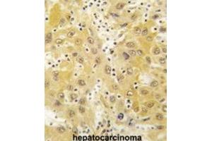 Immunohistochemistry (IHC) image for anti-TCDD-Inducible Poly(ADP-Ribose) Polymerase (Tiparp) antibody (ABIN3003615) (Tiparp antibody)