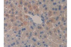Detection of DLD in Mouse Liver Tissue using Polyclonal Antibody to Dihydrolipoyl Dehydrogenase (DLD) (DLD antibody  (AA 45-271))