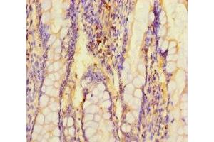 Immunohistochemistry of paraffin-embedded human small intestine tissue using ABIN7143485 at dilution of 1:100 (ARL15 antibody  (AA 1-204))