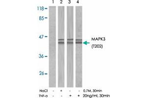 Western blot analysis of extracts from MCF7 (Lane 3), 293T(Lane 1 and 2) and Hela (Lane 4) cells using MAPK3 (phospho T202) polyclonal antibody . (ERK1 antibody  (pThr202))