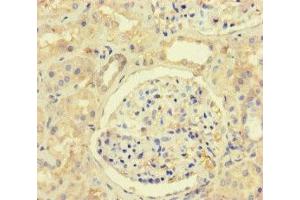 Immunohistochemistry of paraffin-embedded human kidney tissue using ABIN7150201 at dilution of 1:100 (MLH1 antibody  (AA 350-519))