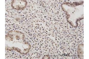 Immunoperoxidase of purified MaxPab antibody to RSC1A1 on formalin-fixed paraffin-embedded human endometrium. (RSC1A1 antibody  (AA 1-617))