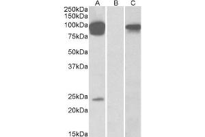 HEK293 lysate (10ug protein in RIPA buffer) overexpressing Human TRPV3 with DYKDDDDK tag probed with ABIN570683 (0. (TRPV3 antibody  (AA 762-773))
