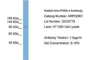 WB Suggested Anti-PIWIL4  Antibody Titration: 0. (PIWIL4 antibody  (N-Term))