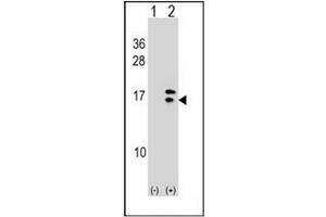 Western blot analysis of CRABP2 (arrow) using CRABP2 Antibody (C-term) Cat. (CRABP2 antibody  (C-Term))